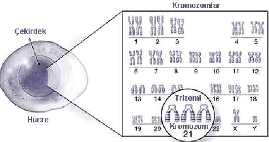 Down Sendromu Kromozom Says